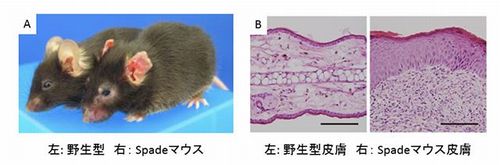 アトピー性皮膚炎