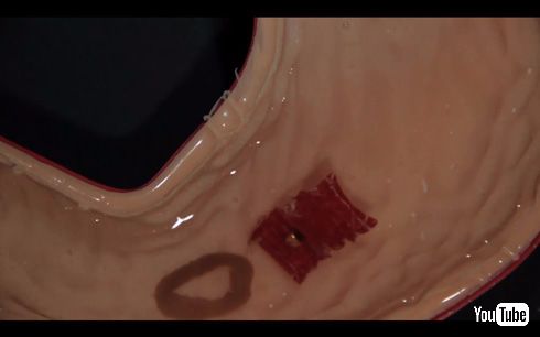 Ingestible origami robot