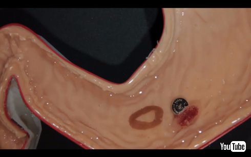 Ingestible origami robot