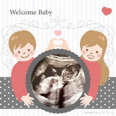 織田信成 第3子エコー写真