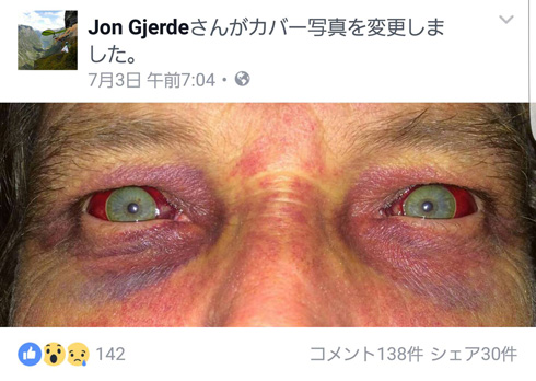 グライダー落下