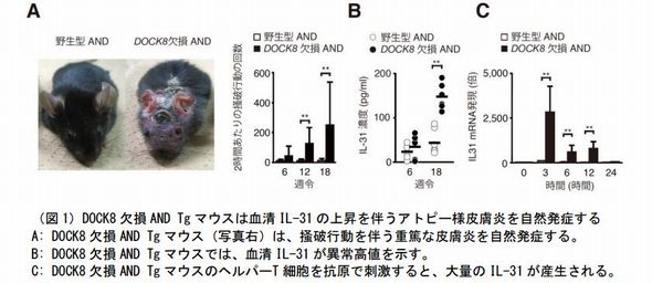 アトピー性皮膚炎　発見　メカニズム　治療薬