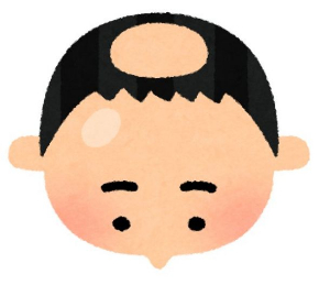 いらすとや いろいろな形 薄毛 イラスト 禿頭 ハゲ