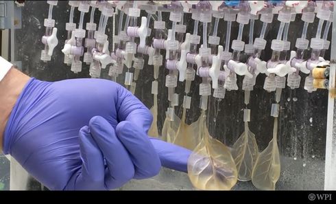 ホウレンソウ　心臓