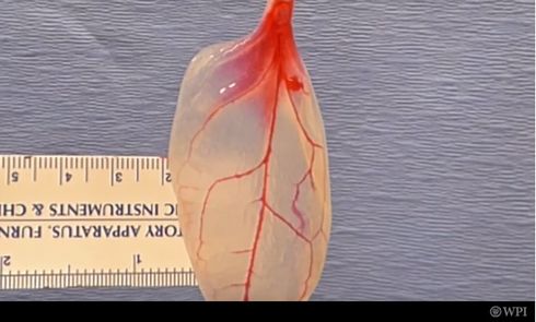 ホウレンソウ　心臓