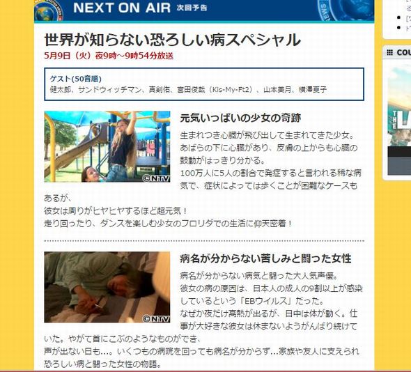 松来未祐　慢性活動性EBウイルス感染症　世界仰天ニュース