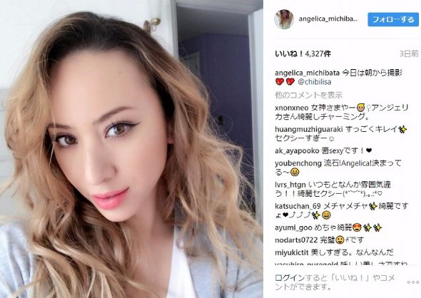 道端アンジェリカ　乾癬
