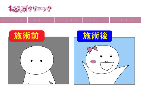 術前術後に大変身したイメージ