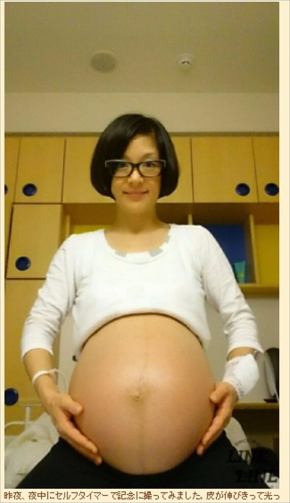 加藤貴子　第2子 出産 帝王切開