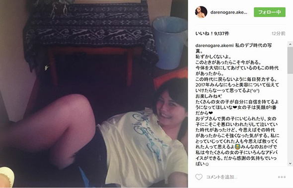 ダレノガレ明美 67キロ デブ時代