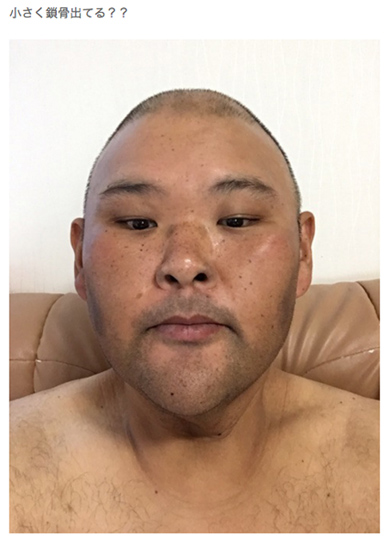 安田大サーカス HIRO 痩せた