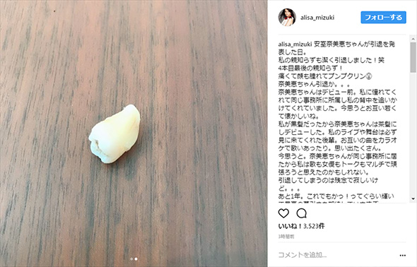 観月ありさ 親知らず 頬　腫れる