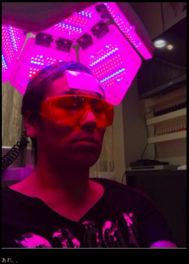 狩野英孝 ブログ 髪 アンチエイジング