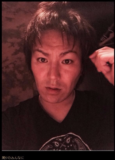 狩野英孝 ブログ 髪 アンチエイジング