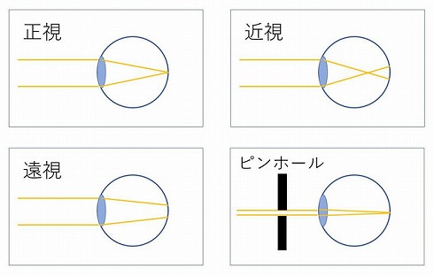 ピンホールメガネ定規