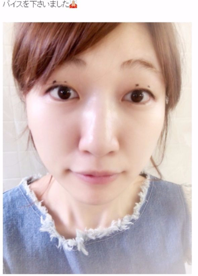 桃 あいのり 整形 二重 埋没法