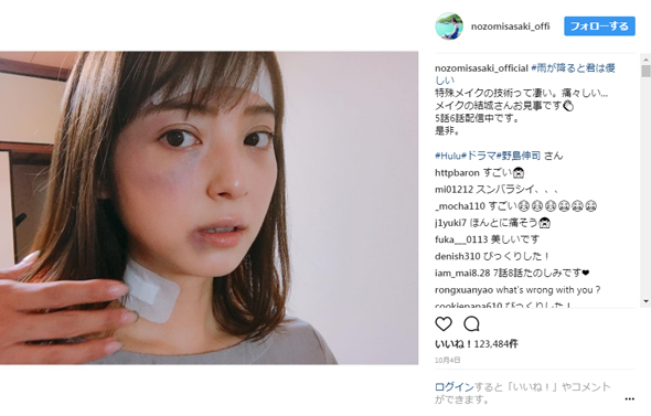 佐々木希 特殊メイク あざ