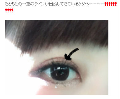 桃　プチ整形　あいのり