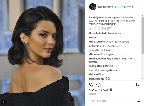 ケンダル・ジェンナー