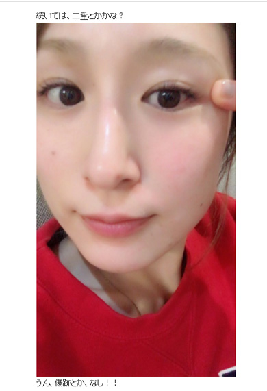 おかもとまり 整形 検証