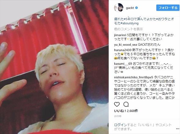 GACKT 格付けチェック 高熱 円形脱毛症