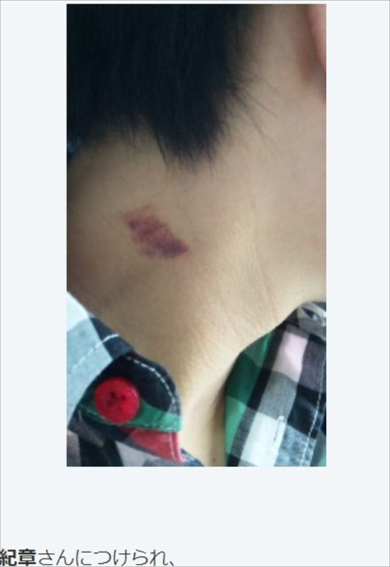 谷山紀章 下野紘 きしょしも キスマーク