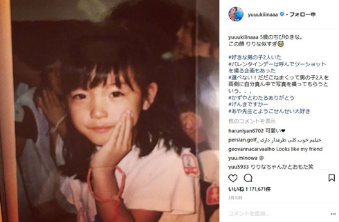 木下優樹菜　涙袋　整形疑惑