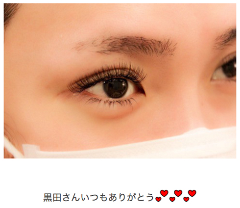 ゆしん　オネエ　整形　二重まぶた　カミングアウト