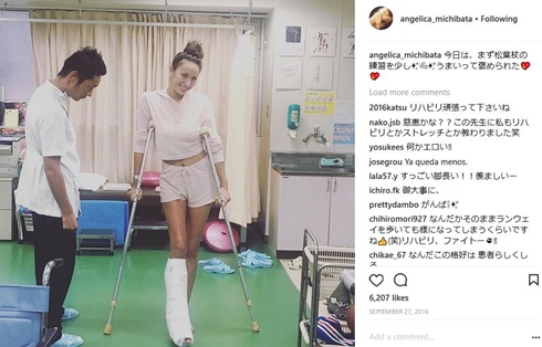 道端アンジェリカ　足　骨折