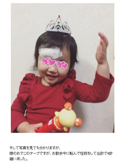 井上和香　娘　ケガ