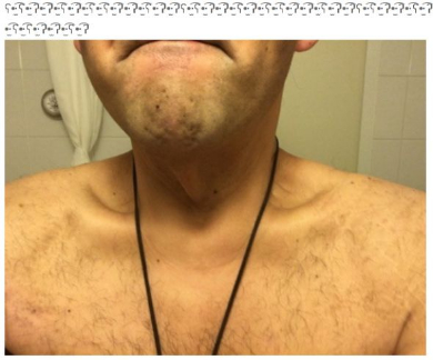 HIRO ダイエット 成功