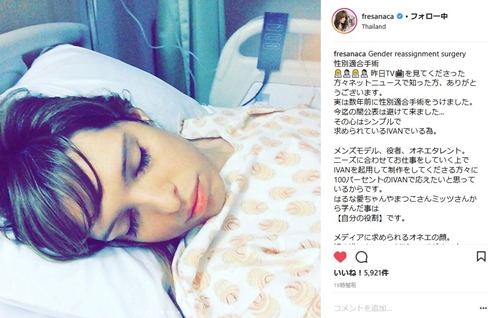 IVAN　モデル　性適合手術