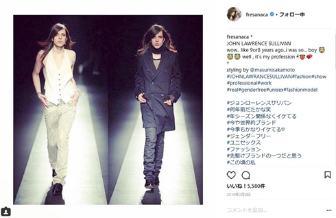 IVAN　モデル　性適合手術