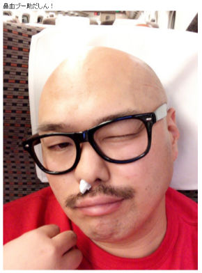 クロちゃん 芸人 2型糖尿病 森田豊医師 食生活 名医のTHE太鼓判！ 鼻血 入院