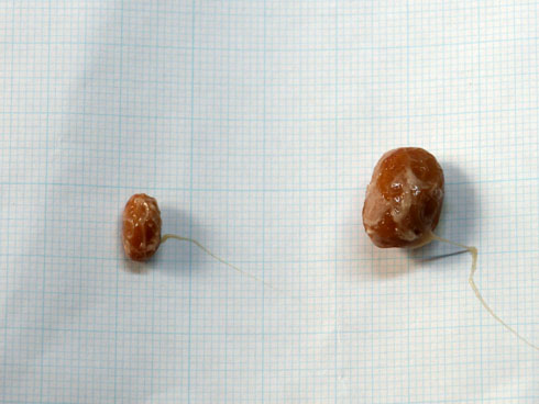 納豆の大きさの調査