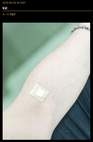 狩野英孝 お笑い アレルギー 血液検査 スカウター IgE アトピー