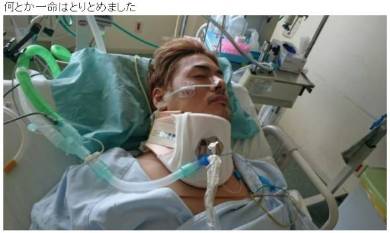 滝川英治 弱虫ペダル 転倒事故 脊髄損傷 滝川クリステル いとこ