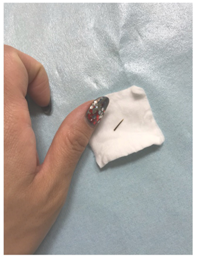 キンタロー。 お尻 皮膚科 トゲ ストレッチ