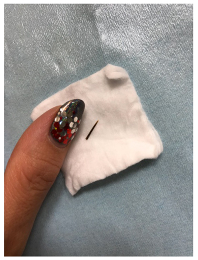 キンタロー。 お尻 皮膚科 トゲ ストレッチ