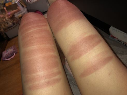 日焼け ダメージ ズボン ジーンズ