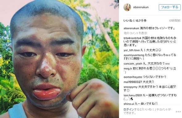 あばれる君 ヒゲ 無精 ひげ ワイルド 不審