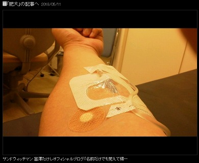富澤たけし 精巣上体炎 サンドウィッチマン 伊達みきお ブログ
