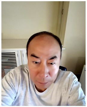 モト冬樹 ハゲ 頭 妻 ブログ 前頭部 抜け毛