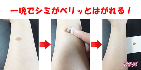 シミが剥がれるクリーム