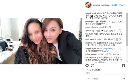 道端アンジェリカ GENKING ほのあかり 乾癬