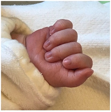 ぺこ りゅうちぇるさん 出産 リンク 名前