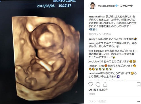 矢沢心 魔裟斗 不妊治療 妊娠 体外受精 第3子