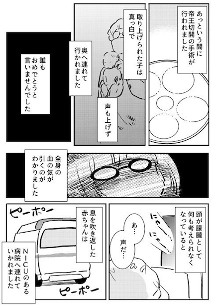 あさのゆきこ 早産 帝王切開