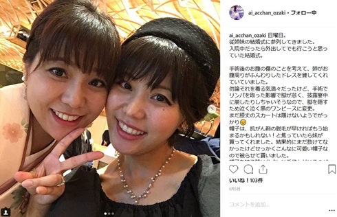 尾崎亜衣 子宮頚がん 闘病 結婚 嘉人