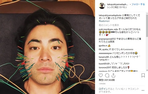 山田孝之 美容針 インスタ Instagram 小栗旬